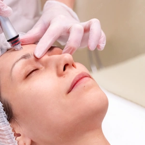ГИДРОПИЛИНГ НА АППАРАТЕ HYDRA PEEL PLUS